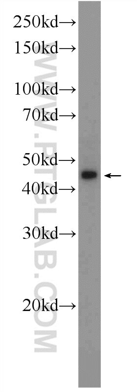Western Blot (WB) analysis of rat colon tissue using NR1H3 Polyclonal antibody (14351-1-AP)