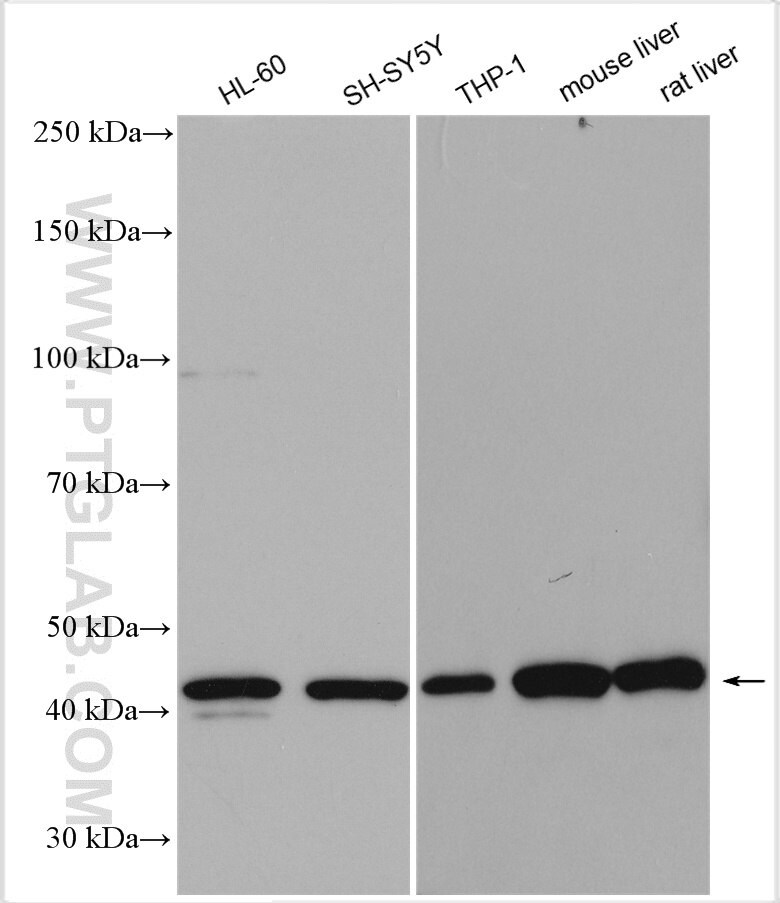 Western Blot (WB) analysis of various lysates using NR1H3 Polyclonal antibody (14351-1-AP)