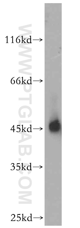 Western Blot (WB) analysis of Sp2/0 cells using NR1H3 Polyclonal antibody (14351-1-AP)