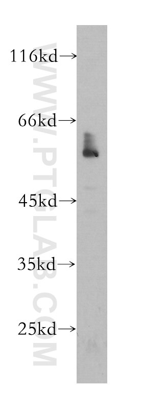 Western Blot (WB) analysis of MCF-7 cells using NR1H3 Monoclonal antibody (60134-1-Ig)
