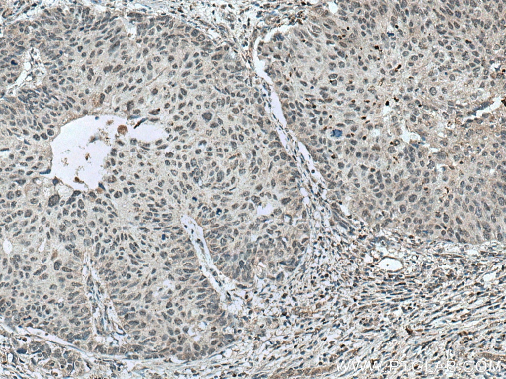 Immunohistochemistry (IHC) staining of human kidney tissue using NR1H4 Polyclonal antibody (25055-1-AP)