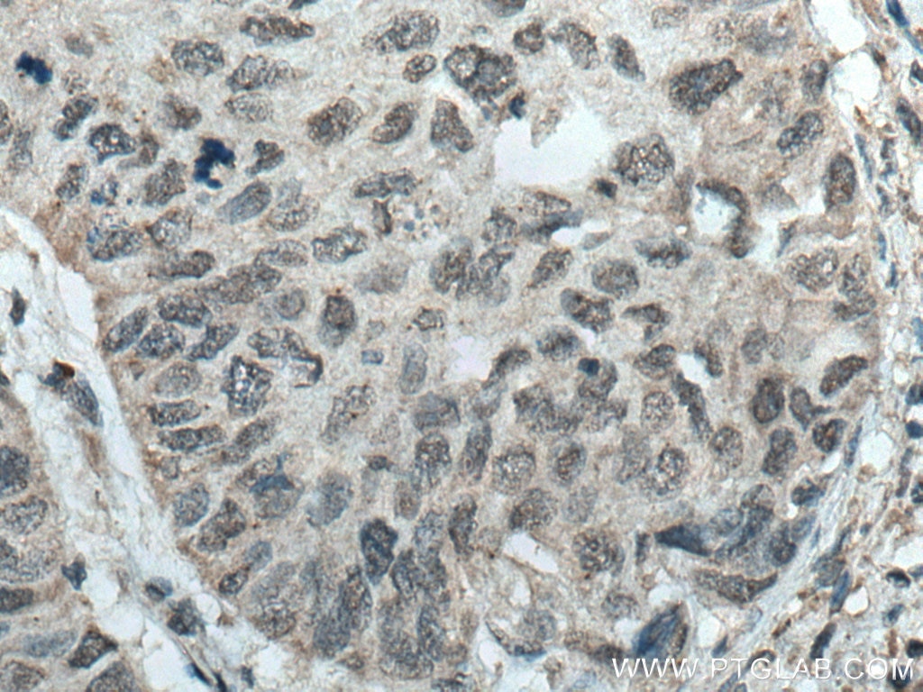 Immunohistochemistry (IHC) staining of human kidney tissue using NR1H4 Polyclonal antibody (25055-1-AP)