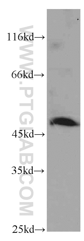 Western Blot (WB) analysis of MCF-7 cells using PXR Polyclonal antibody (15607-1-AP)