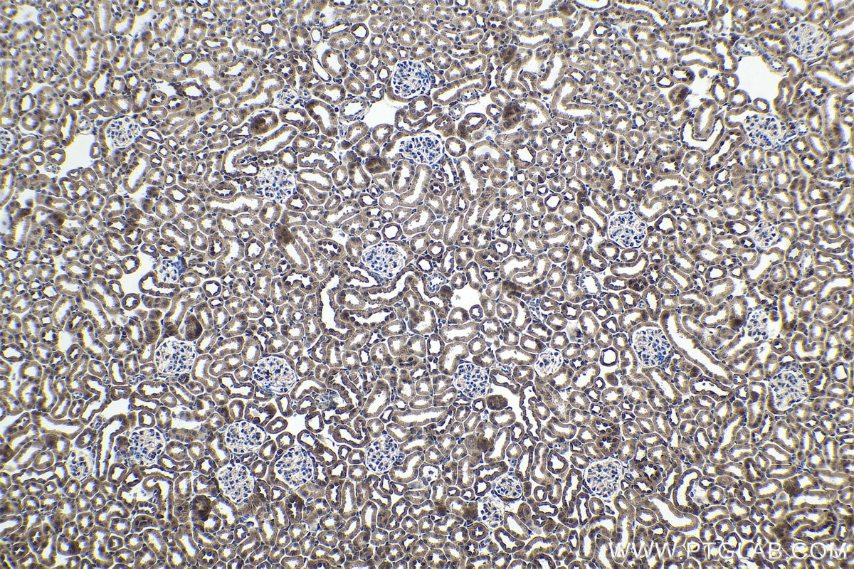 IHC staining of mouse kidney using 21042-1-AP