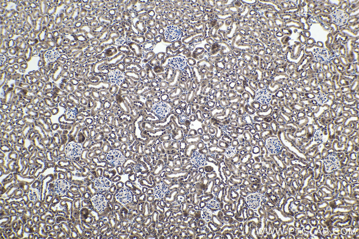 Immunohistochemistry (IHC) staining of mouse kidney tissue using NR1I3 Polyclonal antibody (21042-1-AP)