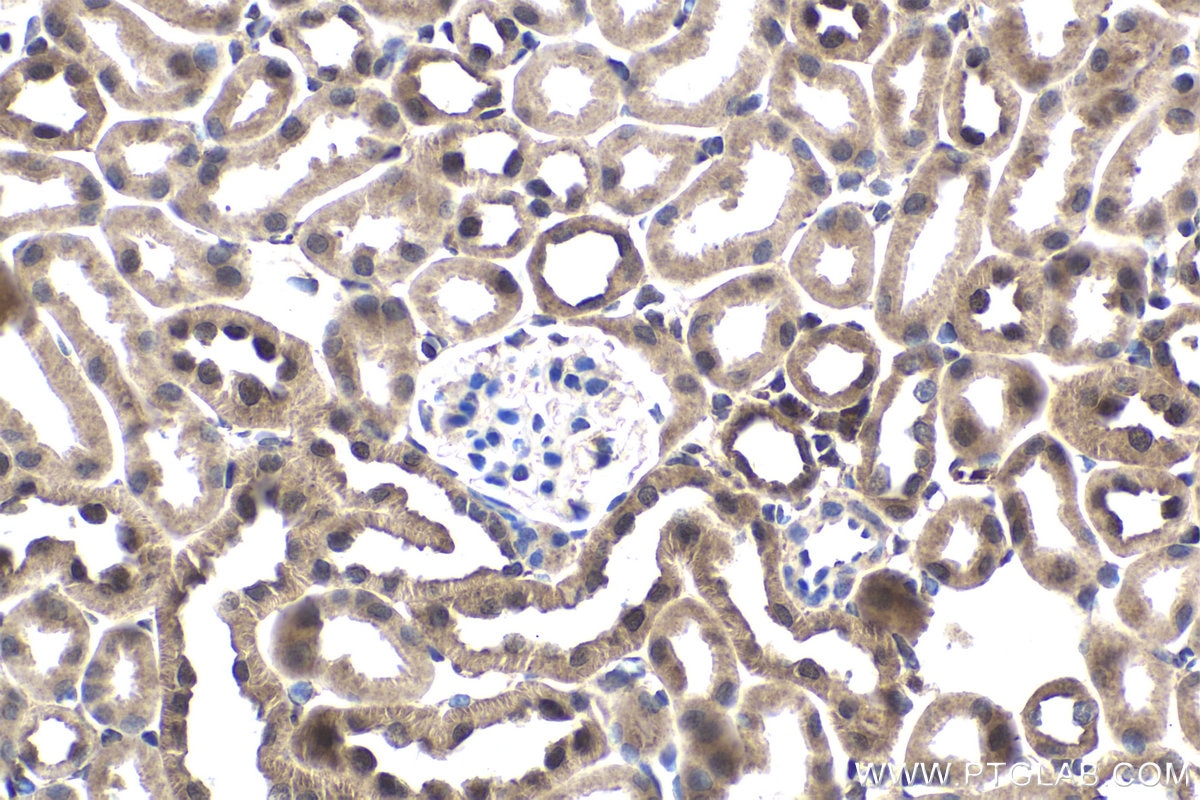 Immunohistochemistry (IHC) staining of mouse kidney tissue using NR1I3 Polyclonal antibody (21042-1-AP)