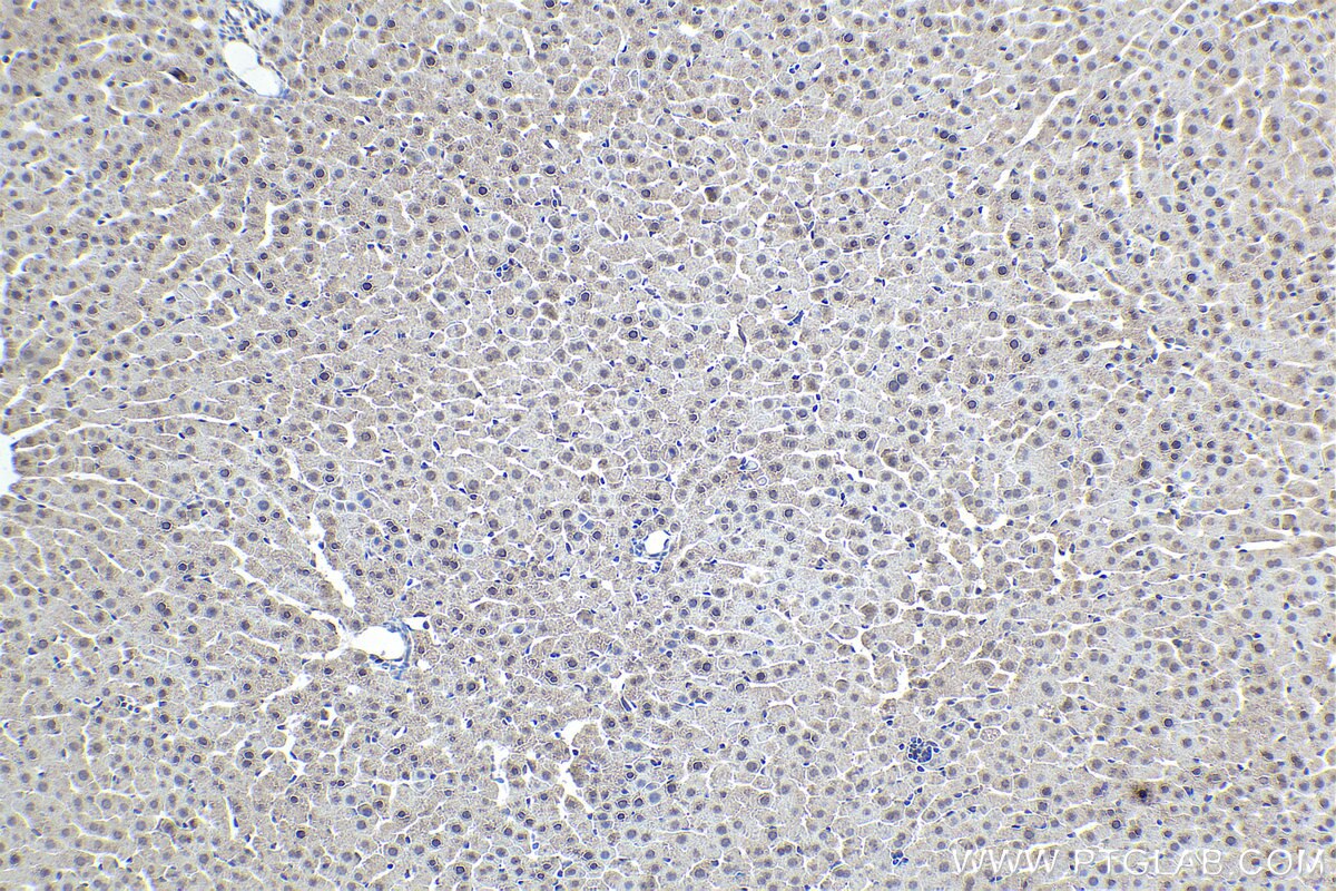 Immunohistochemistry (IHC) staining of rat liver tissue using NR1I3 Polyclonal antibody (21042-1-AP)