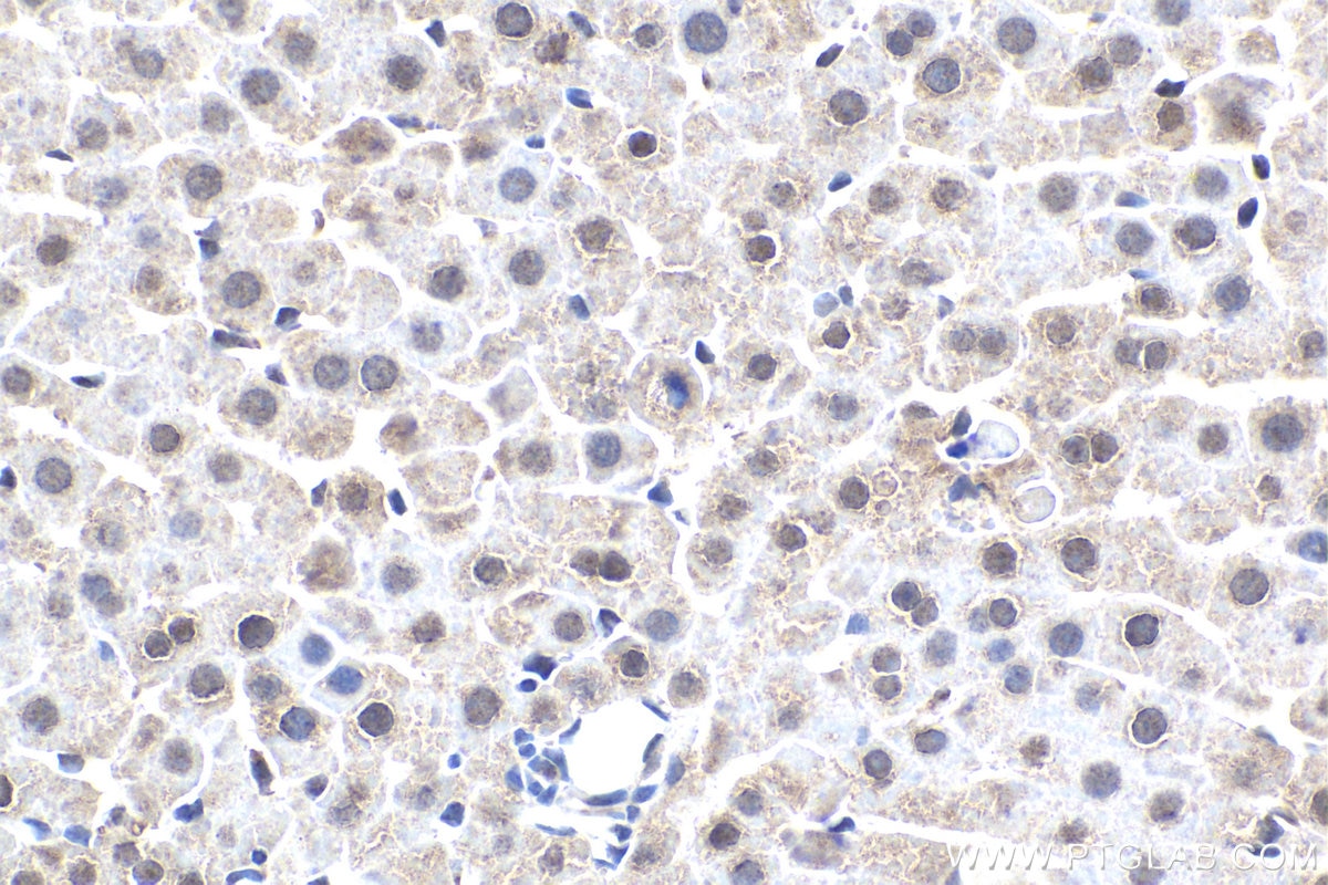 Immunohistochemistry (IHC) staining of rat liver tissue using NR1I3 Polyclonal antibody (21042-1-AP)