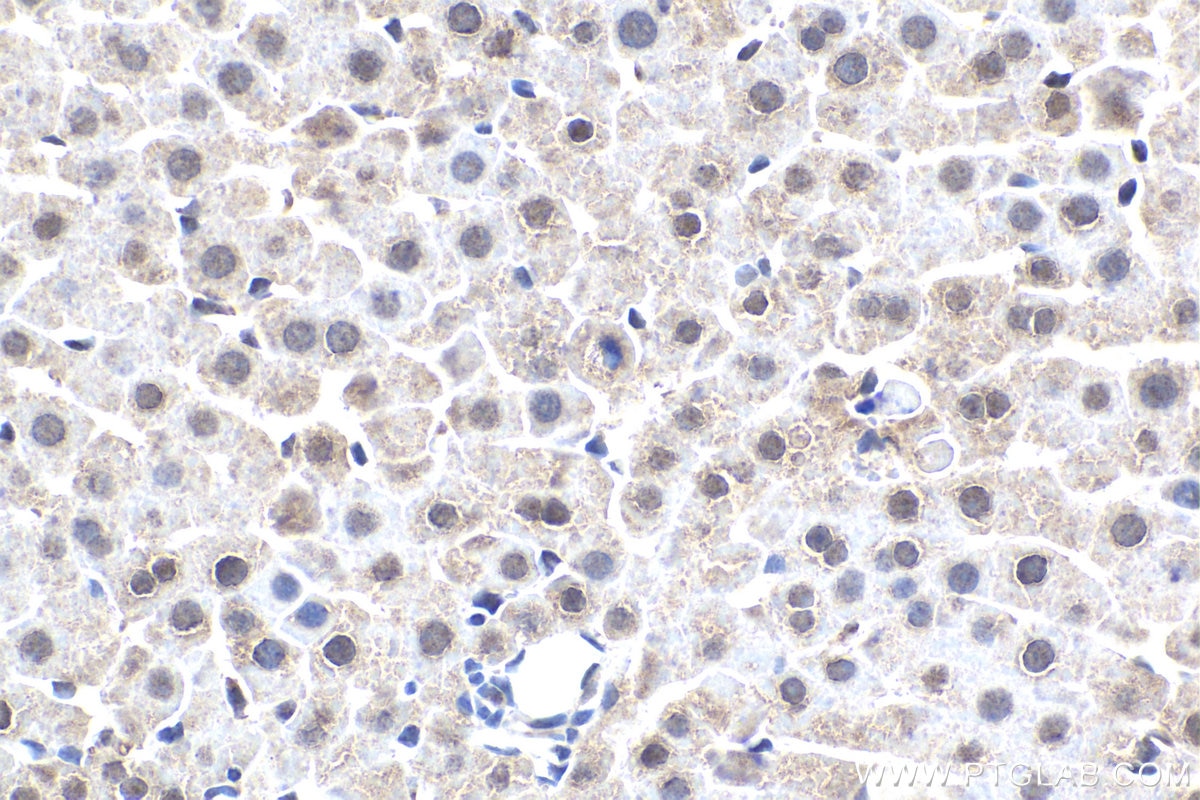 IHC staining of rat liver using 21042-1-AP