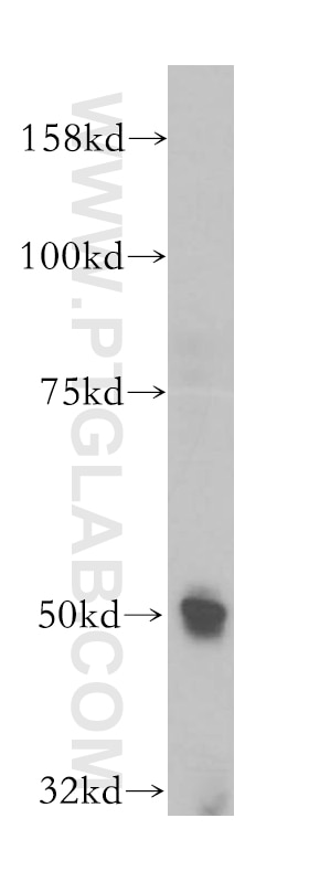 Western Blot (WB) analysis of SH-SY5Y cells using NR2C1 Polyclonal antibody (13658-1-AP)