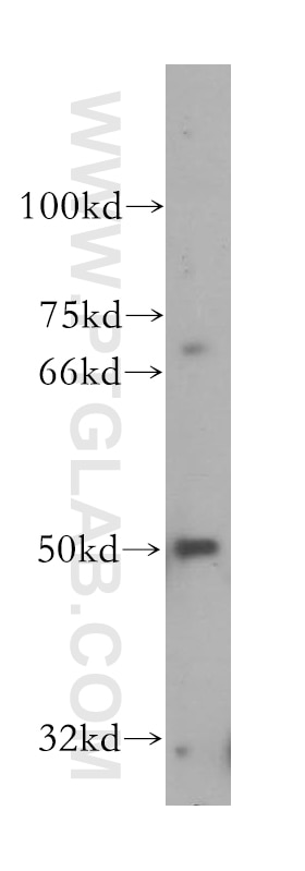 Western Blot (WB) analysis of PC-3 cells using NR2C1 Polyclonal antibody (13658-1-AP)