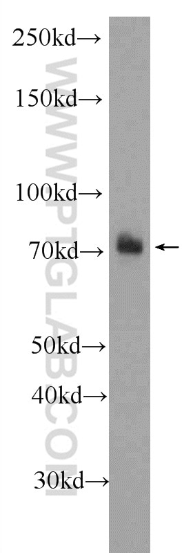 Western Blot (WB) analysis of HeLa cells using NR2C2 Polyclonal antibody (20981-1-AP)