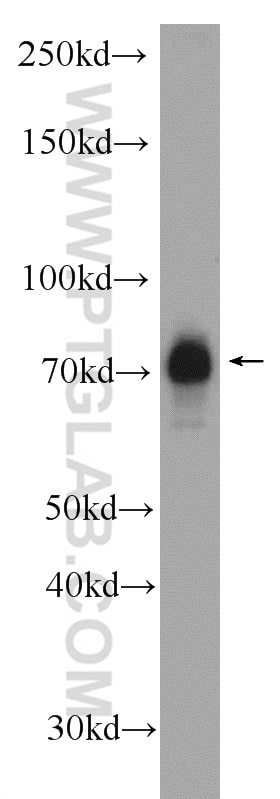Western Blot (WB) analysis of Jurkat cells using NR2C2 Polyclonal antibody (20981-1-AP)