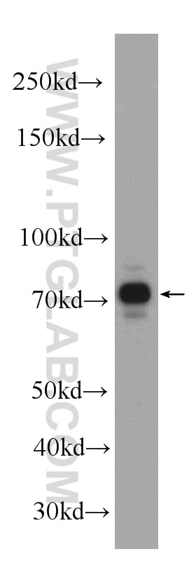 Western Blot (WB) analysis of PC-3 cells using NR2C2 Polyclonal antibody (20981-1-AP)