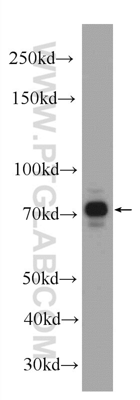 WB analysis of PC-3 using 20981-1-AP