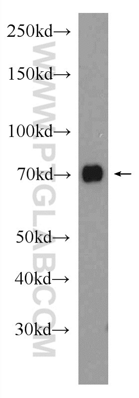 Western Blot (WB) analysis of HeLa cells using NR2C2 Polyclonal antibody (20981-1-AP)