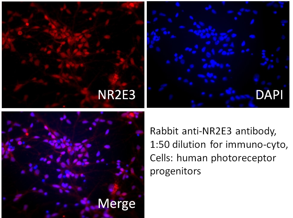 Immunofluorescence (IF) / fluorescent staining of photoreceptor progenitor cells using NR2E3 Polyclonal antibody (14246-1-AP)