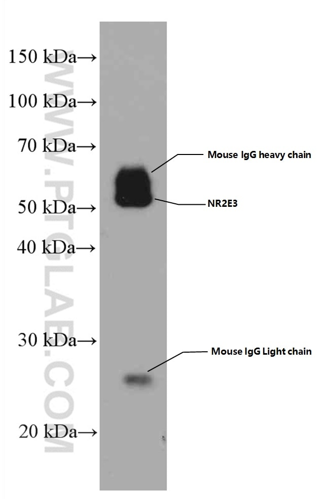 WB analysis of mouse retina using 66494-1-Ig