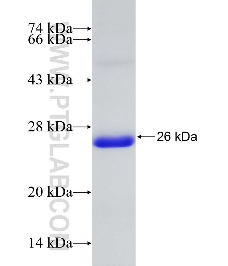 NR2E3 fusion protein Ag31272 SDS-PAGE