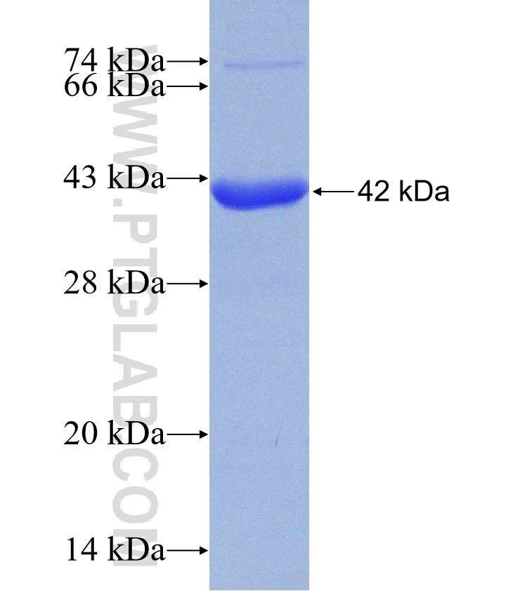 NR2E3 fusion protein Ag5831 SDS-PAGE