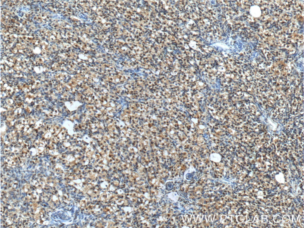 Immunohistochemistry (IHC) staining of human ovary tissue using NR2F1 Polyclonal antibody (24573-1-AP)