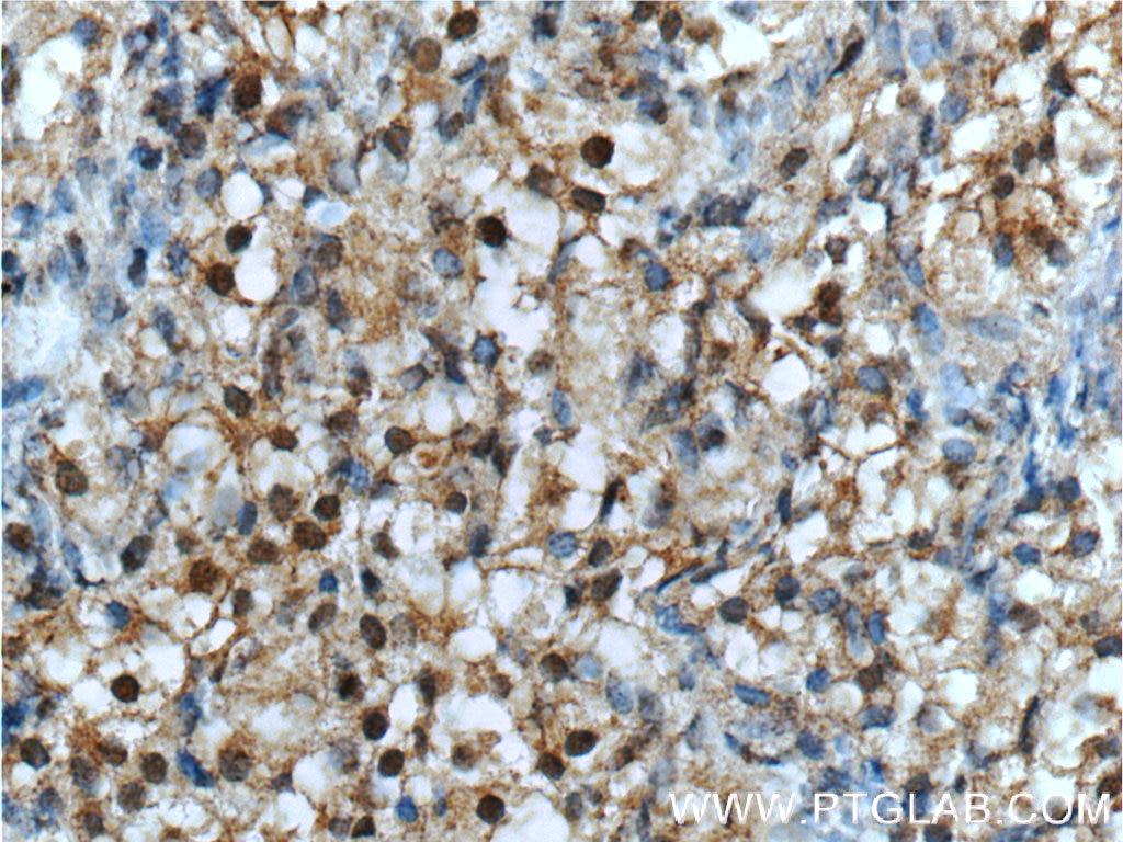 Immunohistochemistry (IHC) staining of human ovary tissue using NR2F1 Polyclonal antibody (24573-1-AP)