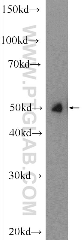 Western Blot (WB) analysis of human placenta tissue using NR2F1 Polyclonal antibody (24573-1-AP)