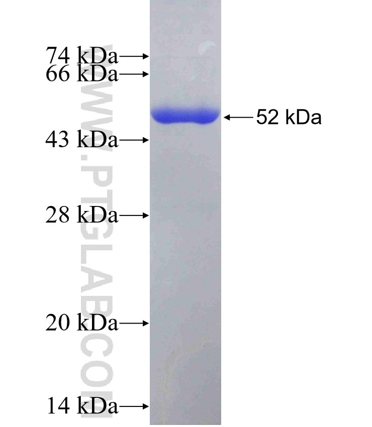 NR2F1 fusion protein Ag0118 SDS-PAGE