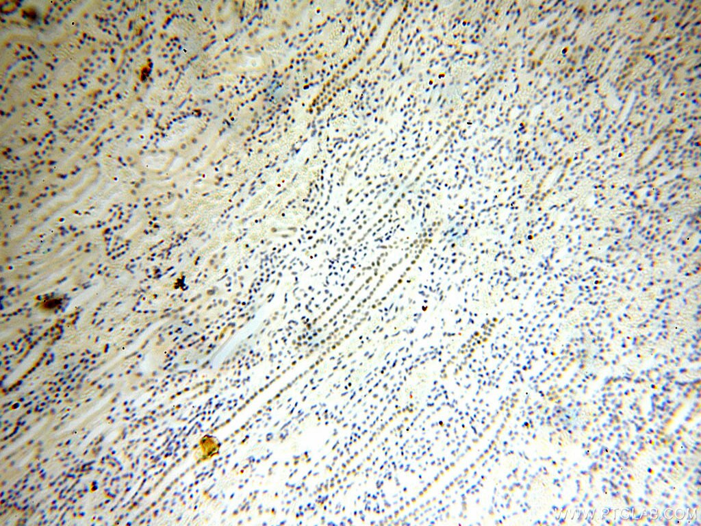 IHC staining of human kidney using 60117-1-Ig