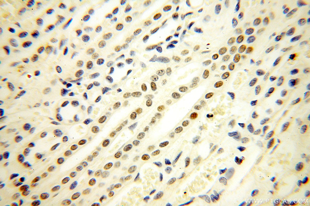 Immunohistochemistry (IHC) staining of human kidney tissue using NR2F6 Monoclonal antibody (60117-1-Ig)