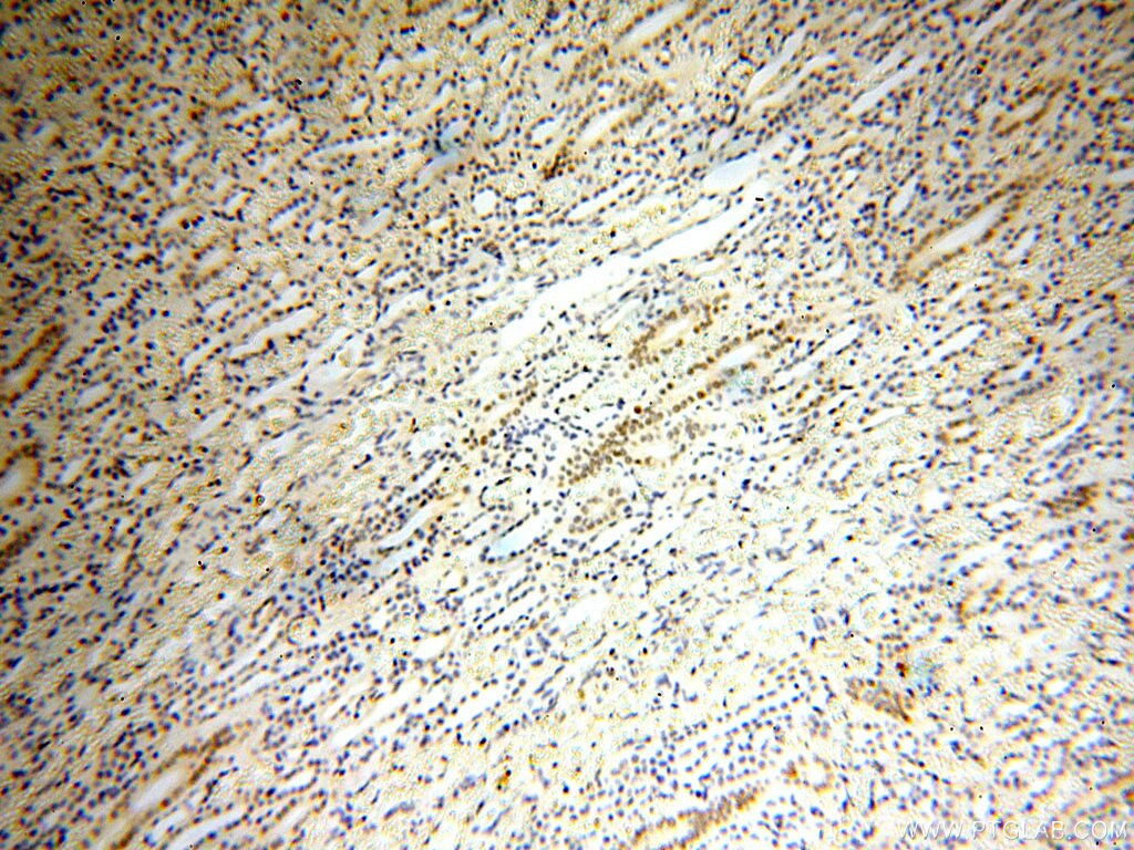 Immunohistochemistry (IHC) staining of human kidney tissue using NR2F6 Monoclonal antibody (60117-1-Ig)