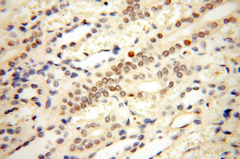 Immunohistochemistry (IHC) staining of human kidney tissue using NR2F6 Monoclonal antibody (60117-1-Ig)