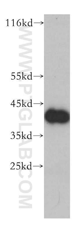 Western Blot (WB) analysis of MCF-7 cells using NR2F6 Monoclonal antibody (60117-1-Ig)