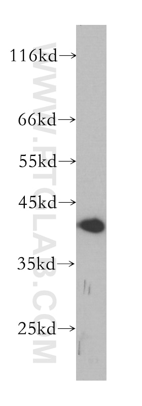 Western Blot (WB) analysis of MCF-7 cells using NR2F6 Monoclonal antibody (60117-1-Ig)