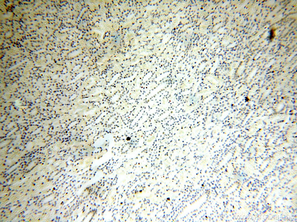 Immunohistochemistry (IHC) staining of human kidney tissue using NR2F6 Monoclonal antibody (60117-2-Ig)