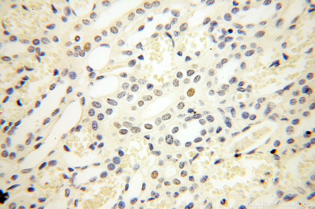 Immunohistochemistry (IHC) staining of human kidney tissue using NR2F6 Monoclonal antibody (60117-2-Ig)