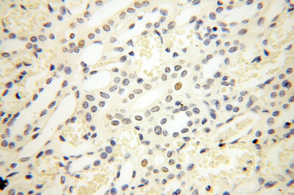 IHC staining of human kidney using 60117-2-Ig