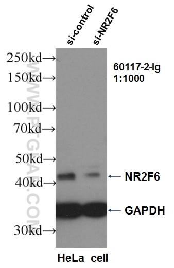 WB analysis of HeLa using 60117-2-Ig