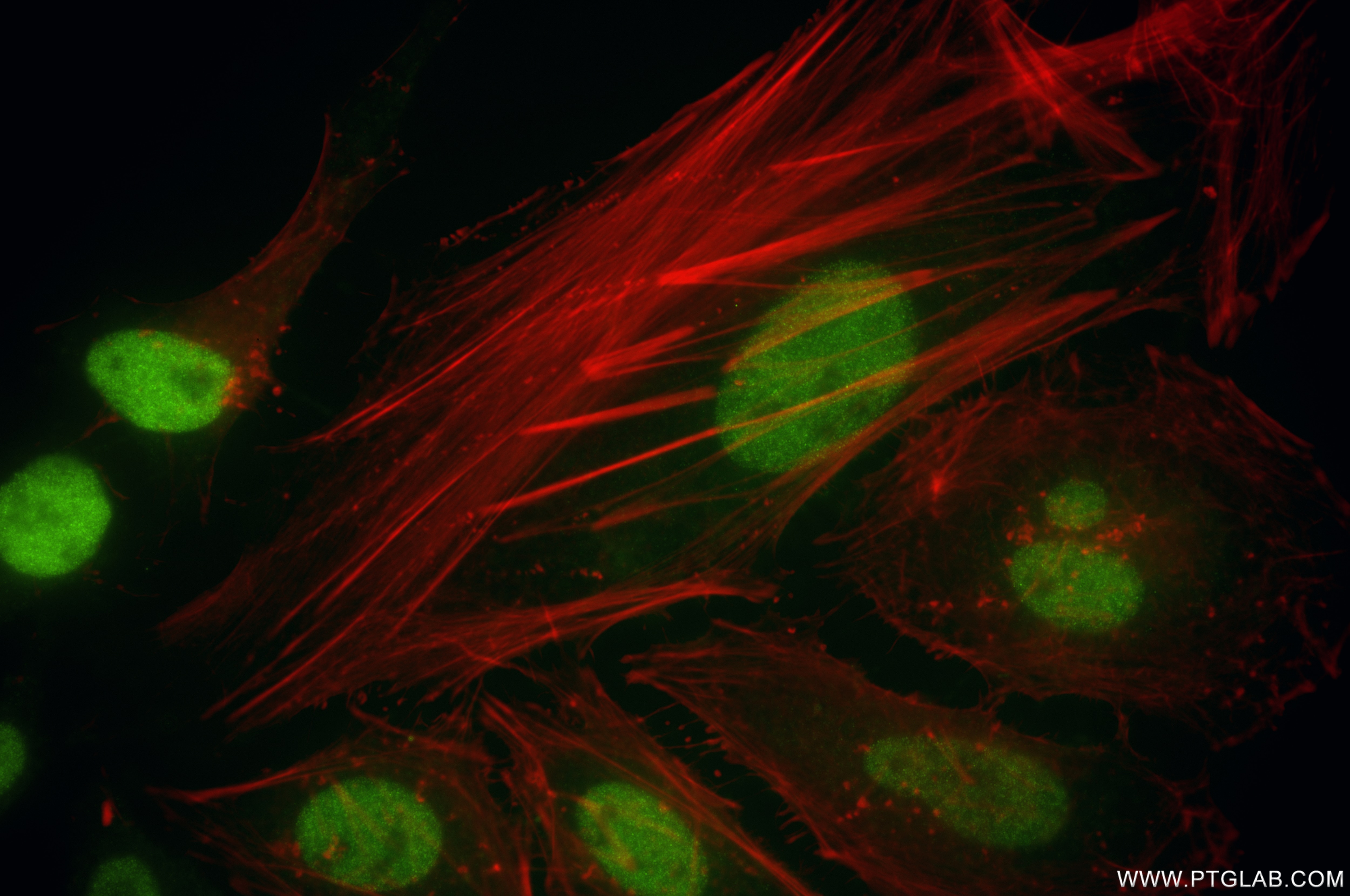 Immunofluorescence (IF) / fluorescent staining of HeLa cells using NR2F6 Recombinant antibody (86371-1-RR)