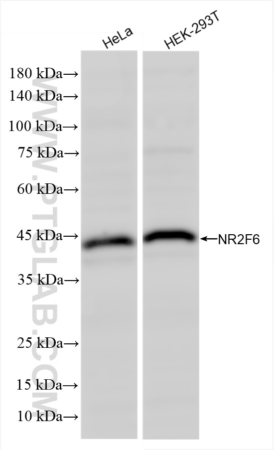 Western Blot (WB) analysis of various lysates using NR2F6 Recombinant antibody (86371-1-RR)