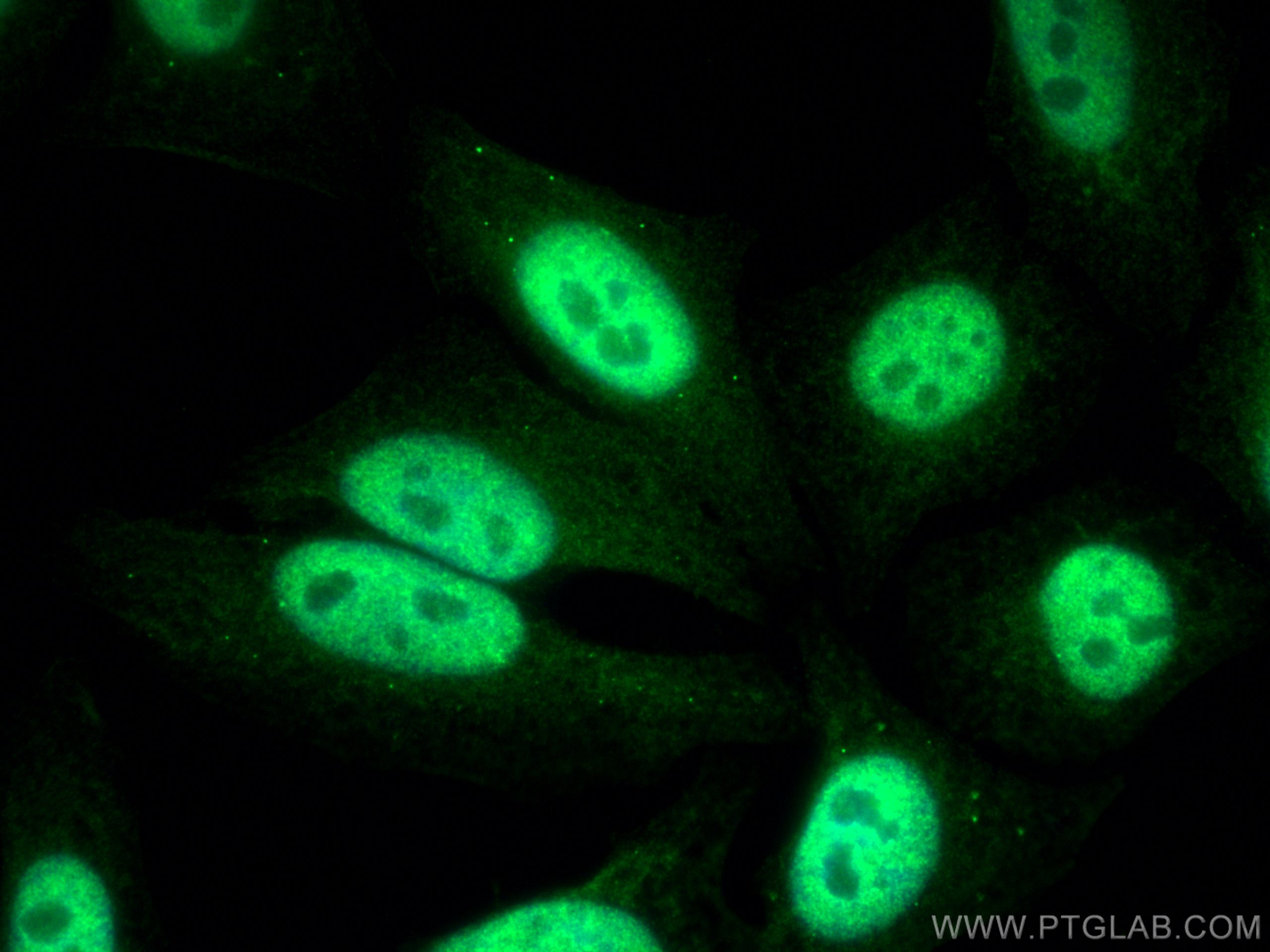 Immunofluorescence (IF) / fluorescent staining of HepG2 cells using Glucocorticoid receptor Polyclonal antibody (24050-1-AP)