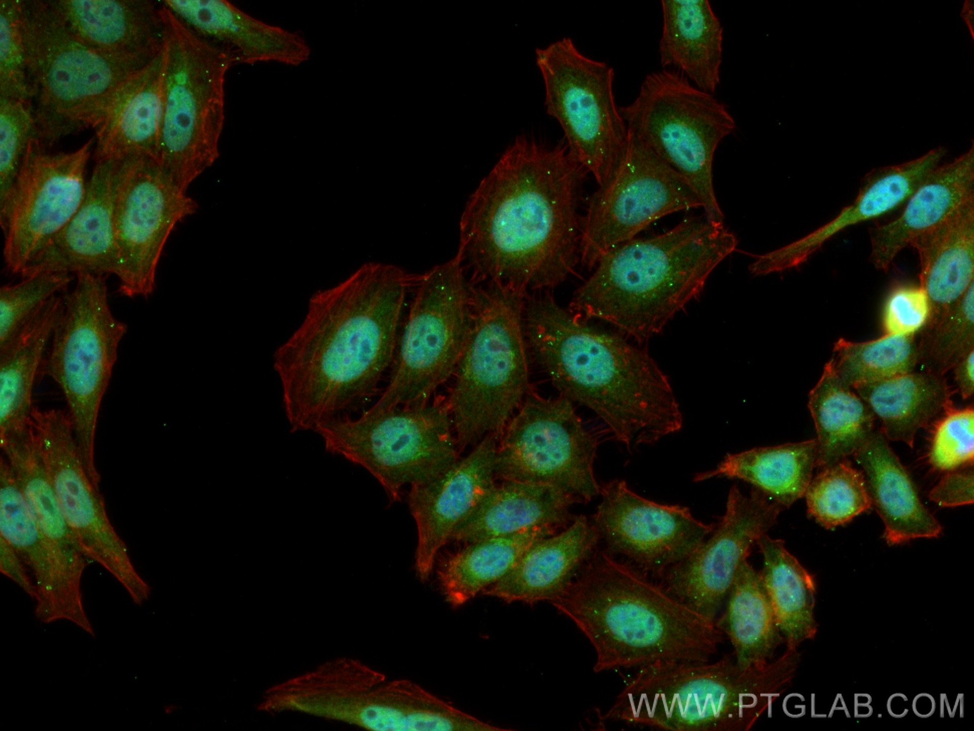 IF Staining of HepG2 using 24050-1-AP