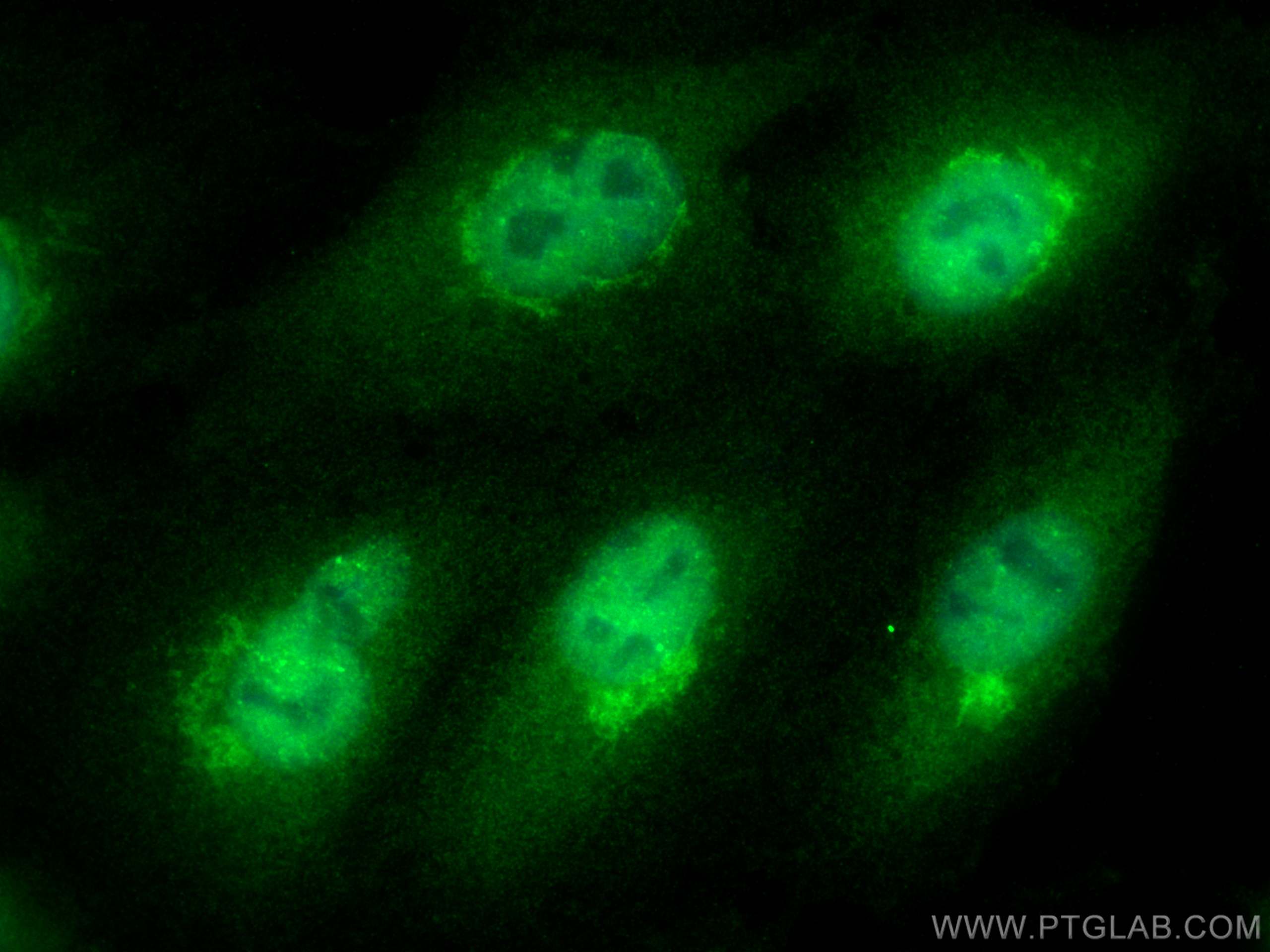 Immunofluorescence (IF) / fluorescent staining of A549 cells using Glucocorticoid receptor Polyclonal antibody (24050-1-AP)
