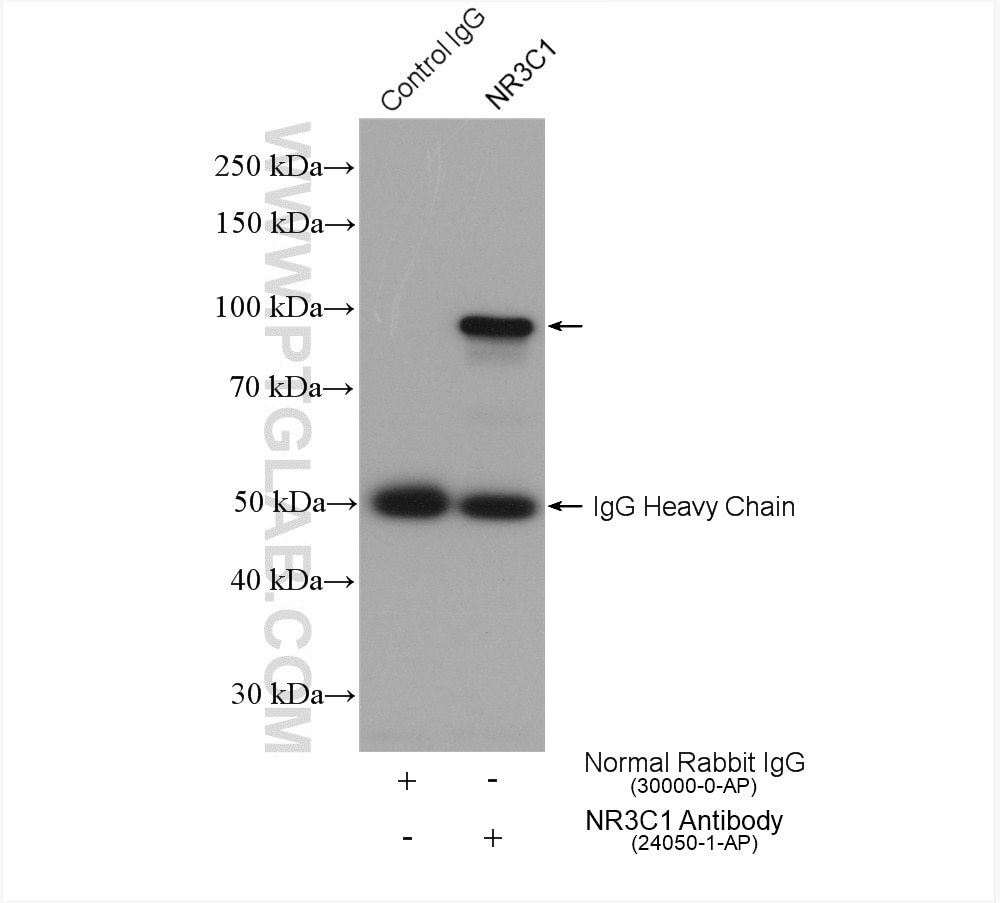 Immunoprecipitation (IP) experiment of HepG2 cells using Glucocorticoid receptor Polyclonal antibody (24050-1-AP)