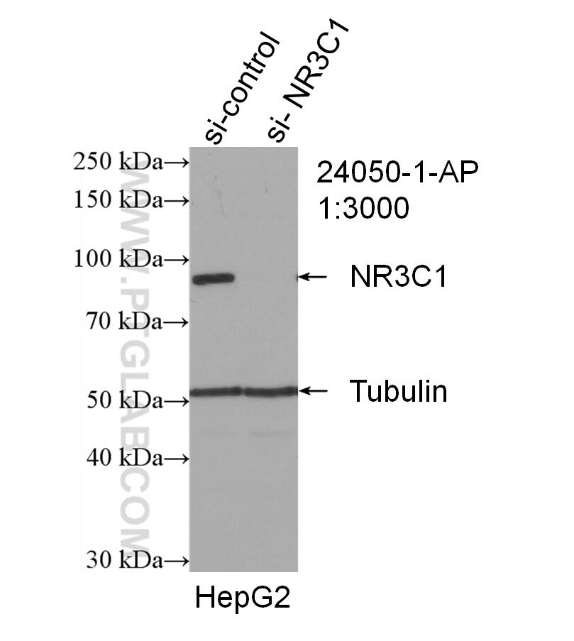 Western Blot (WB) analysis of HepG2 cells using Glucocorticoid receptor Polyclonal antibody (24050-1-AP)