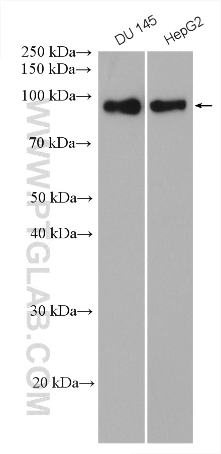 Western Blot (WB) analysis of various lysates using Glucocorticoid receptor Polyclonal antibody (24050-1-AP)