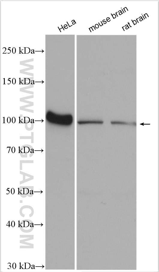 Western Blot (WB) analysis of various lysates using Glucocorticoid receptor Polyclonal antibody (24050-1-AP)