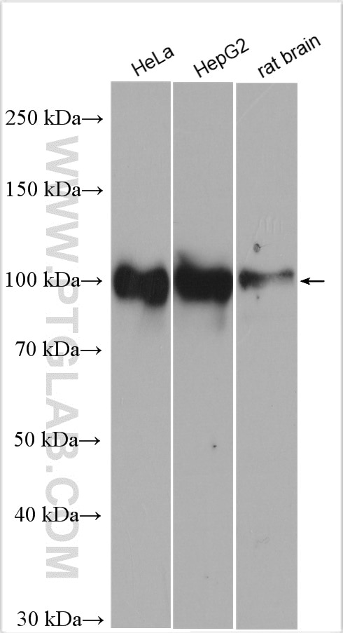 Western Blot (WB) analysis of various lysates using Glucocorticoid receptor Polyclonal antibody (24050-1-AP)