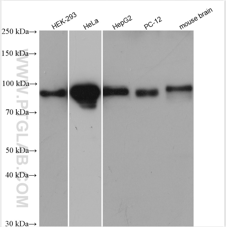 Western Blot (WB) analysis of various lysates using Glucocorticoid receptor Polyclonal antibody (24050-1-AP)