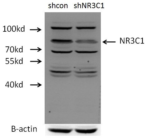 Glucocorticoid receptor Polyclonal antibody